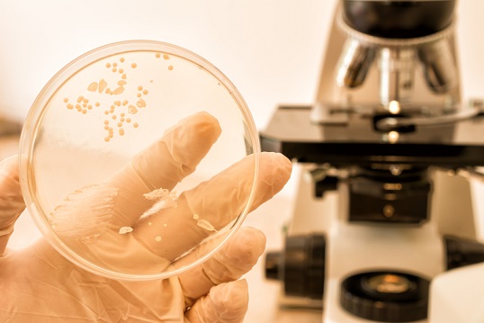MICROSCOPIO CAJA DE PETRI CON HONGOS CANDIDIASIS INFECCIÓN VAGINAL MECANISMOS DE DEFENSA